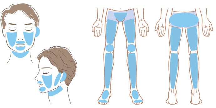 下半身脱毛+ひげ全体