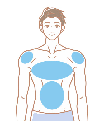 前半身脱毛セット