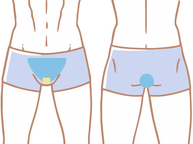 VIOフル脱毛セット