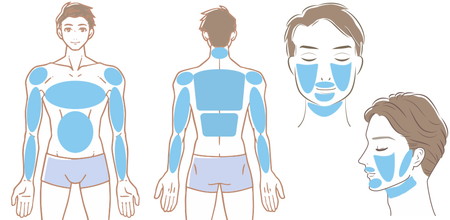 上半身脱毛+ひげ全体