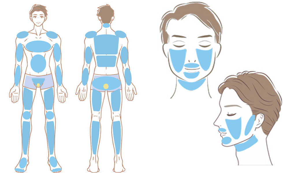 全身脱毛+ひげ全体+VIOフル脱毛